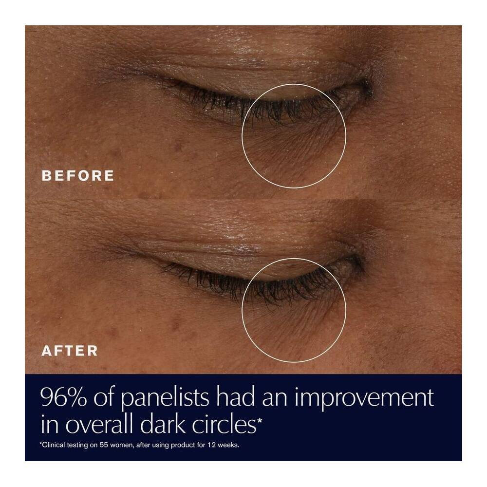  مقایسه تیرگی دور چشم قبل و بعد از استفاده از Advanced Night Repair 